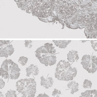 pattern_file